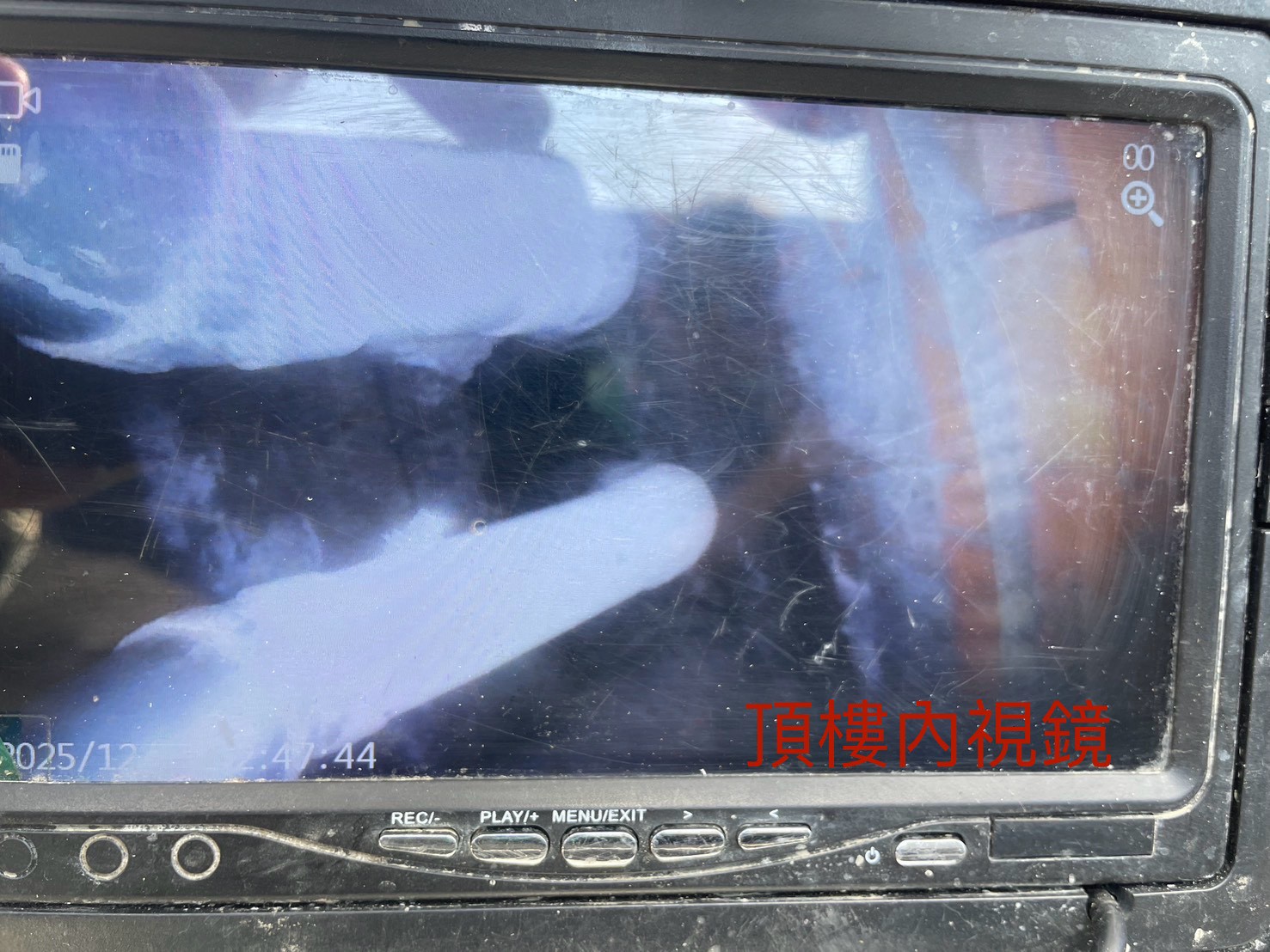 1141211案例分享：【青青校園】管路微創手術—管路內視鏡精密檢測紀錄